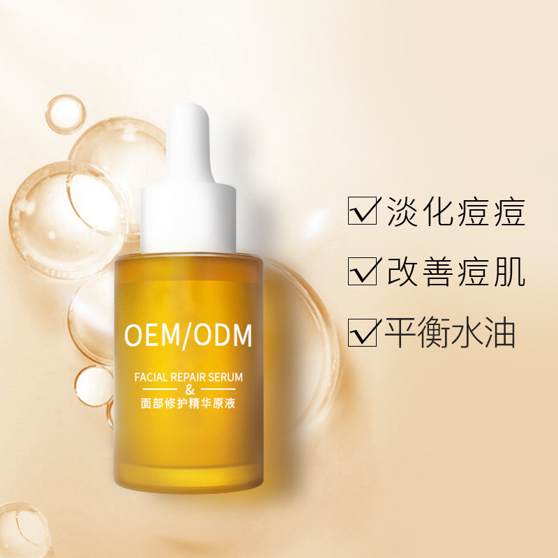 黔南布依族苗族自治州_祛痘精华原液OEM